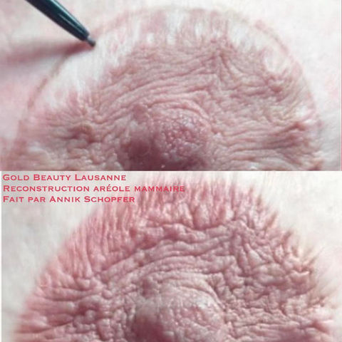 Tatouage aréoles mammaires