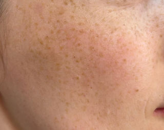maquillage permanent taches de rousseur
