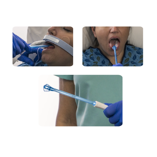 Limpiador Lingual Scrape-n-Suction™