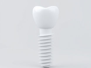 Exploring the Myths and Truths About Ceramic Implants Insights from _The Science Behind Ceramic Dental Implants_
