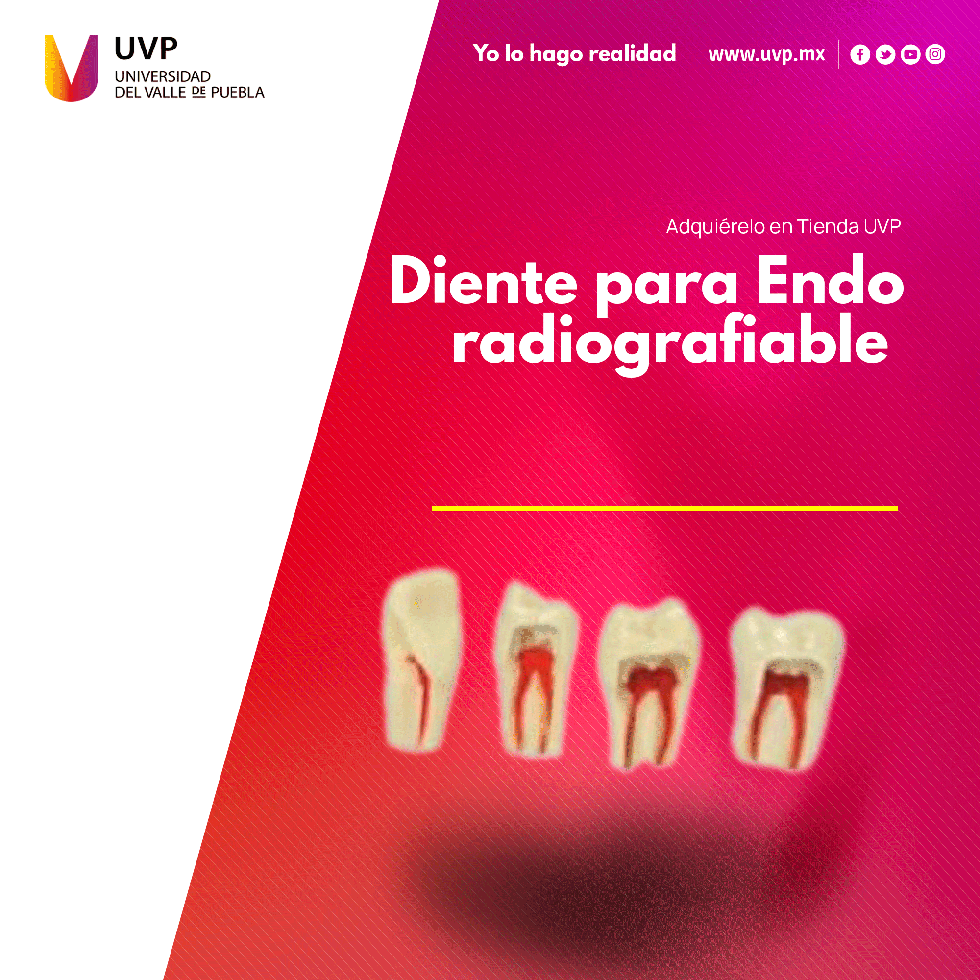 Diente para endo radiografiable