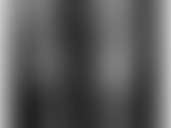 L’articolazione del ginocchio in situazione patologica