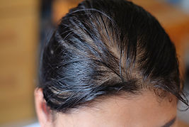 Bald man or woman worry about his or her less thin hair on blur background..jpg