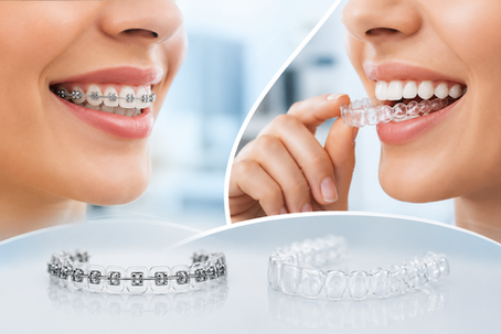 Şeffaf plak ve geleneksel diş teli tedavisini karşılaştıran modern ortodonti görseli. Estetik diş düzeltme yöntemlerini yansıtan profesyonel dental klinik tasarımı.