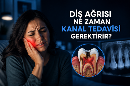 Şiddetli diş ağrısı yaşayan bir hastayı ve kanal tedavisi ihtiyacını anlatan modern dental sağlık konsept görseli.