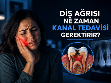 Şiddetli diş ağrısı yaşayan bir hastayı ve kanal tedavisi ihtiyacını anlatan modern dental sağlık konsept görseli.