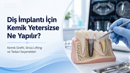 Diş implantı için kemik yetersizliğinde uygulanan kemik grefti, sinüs lifting ve diğer tedavi seçeneklerini gösteren dental implant görseli.