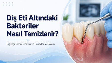 Diş eti altındaki bakterilerin diş taşı temizliği, derin temizlik ve periodontal bakım ile uzaklaştırılmasını gösteren dental görsel.