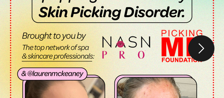 When “Just Popping a Zit” Isn’t Just That: Why Estheticians Are on the Front Lines of Recognizing Skin Picking Disorder