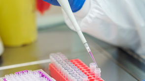 Pruebas PCR en tiempo real y PCR digital utilizadas para detectar mutaciones genéticas en cáncer mediante biopsia líquida y análisis molecular del ADN