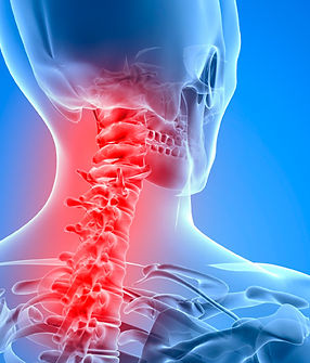 cervicalgia.jpeg