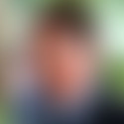 Ex-presidente Bolsonaro está na UTI com broncopneumonia e não tem previsão de alta