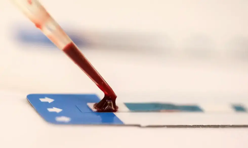Pipeta vermelha depositando gota de sangue em superfície azul com setas brancas. Fundo desfocado, ambiente de laboratório.