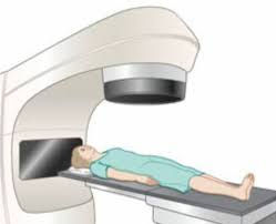 العلاج الإشعاعي و الفطريات
