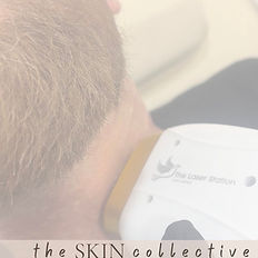 Laser hair removal in portsmouth at the skin collective