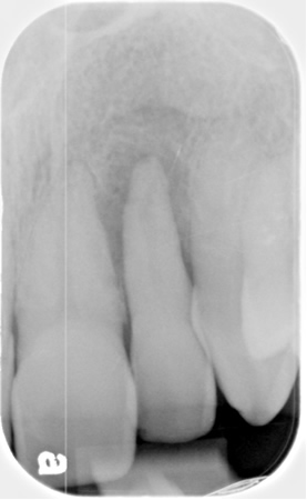 Gum-Disease-Treatment-2011-03.