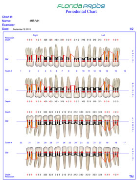 Initial visit Florida Probe Periodontal Chart.