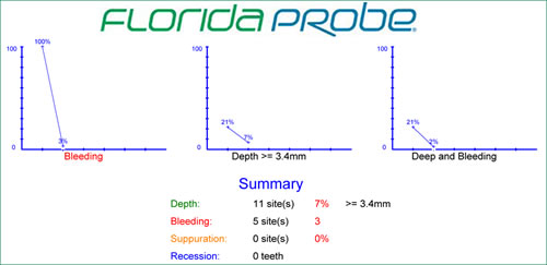 Florida Probe summary chart of gum disease treatment with Perio Protect trays.