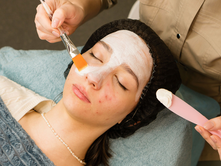 What Acne Treatment Does to Skin Biology