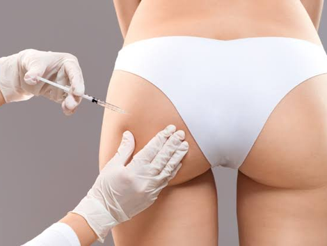 What Makes Body Fillers a Modern Aesthetic Option?