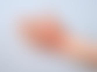 Does Actinic Keratosis Treatment Address Skin Changes