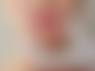 What Lip Filler Price Indicates in Aesthetic Care