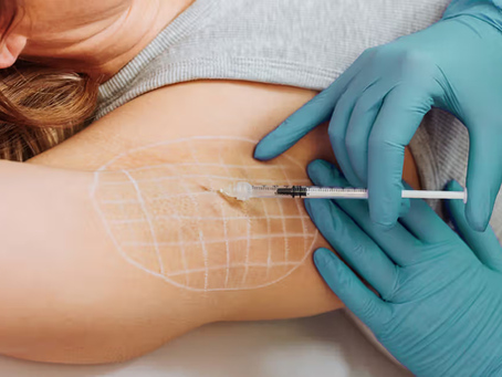 What Under Arms Botox Means Medically?