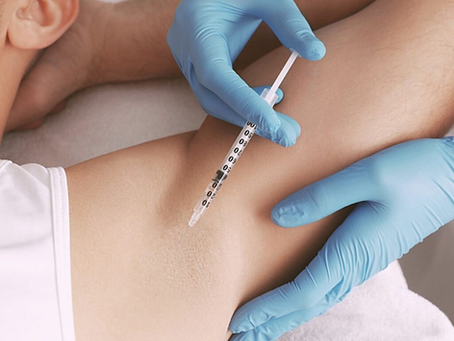 Is Under Arms Botox The Right Choice? A Dermatologist's View