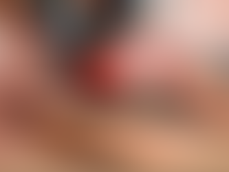 How Does Fractional CO2 Laser Treatment Work?