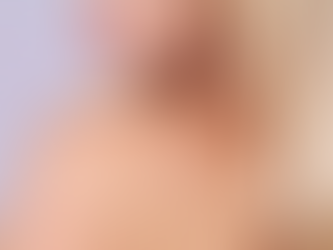 Is Birthmark Removal A Safe Cosmetic Procedure Option?
