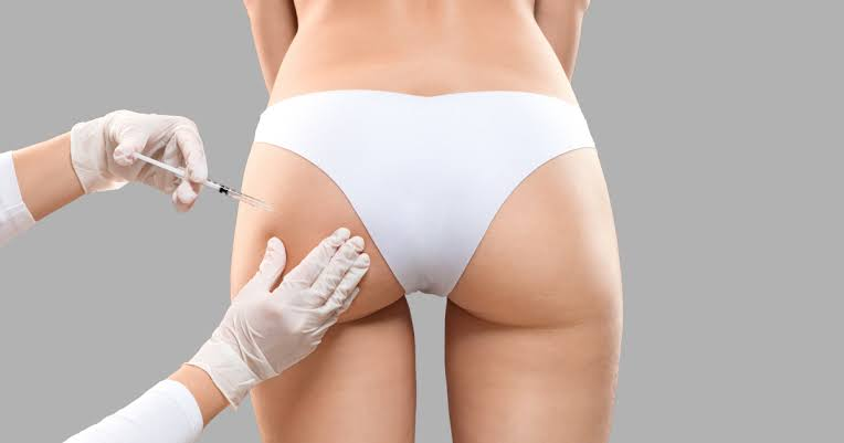 How Do Butt fillers Support Volume Enhancement?