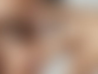 What Fine Lines & Wrinkles Removal Means?