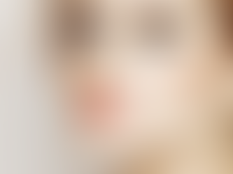 How Rhinoplasty Changes Nasal Structure
