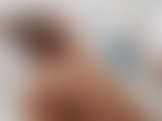 Does Laser Hair Removal Alter Hair Cycles?