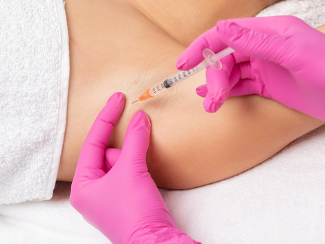 How Reliable Is Under Arms Botox?