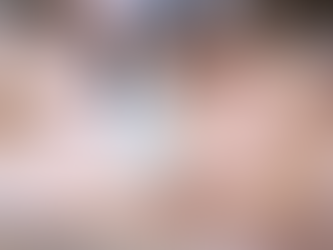 What Is the Coolsculpting Procedure Like for Patients?