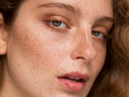 How Does Professional Pigmentation Treatment Help?