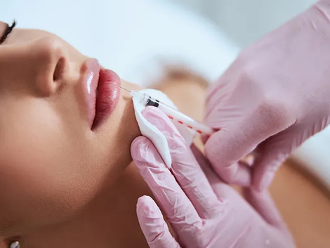 How Does Volbella Filler Address Aging Concerns?