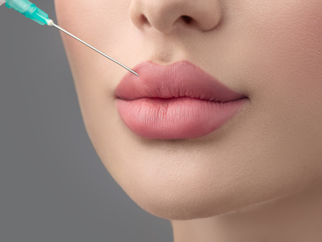 What Makes Russian Lip Fillers A Unique Technique?
