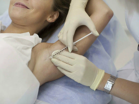 Is Under Arms Botox Considered a Minimally Invasive Procedure?
