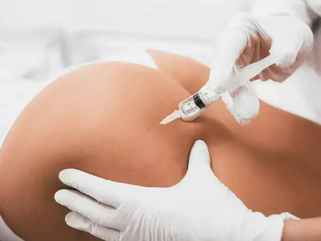 What Are Butt fillers and How Do They Work?