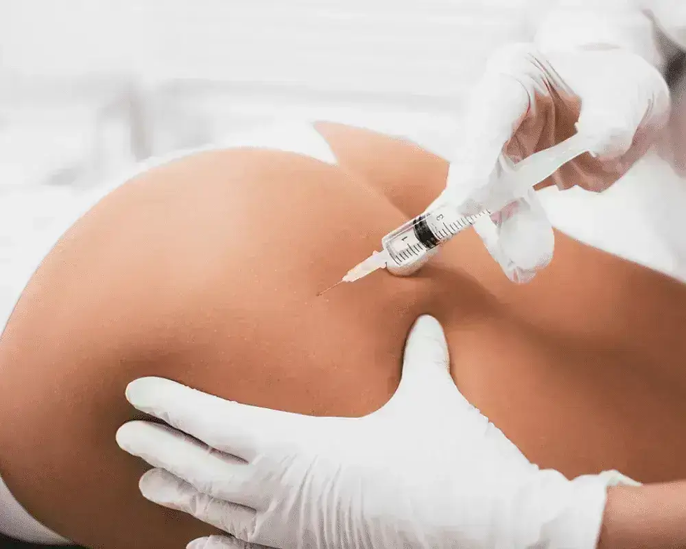 What Are Butt fillers and How Do They Work?