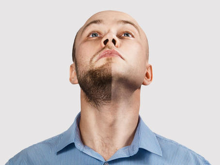 What Is the Process of Beard Hair Transplant?