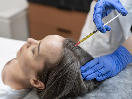 What PRP Hair Treatment Means in Medicine?