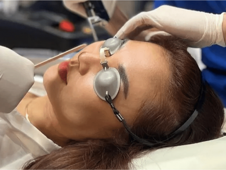 What Is Fractional CO2 Laser Treatment?