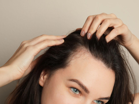Does the Best Hair Loss Treatment Prevent Baldness?