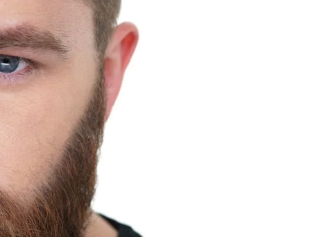 What Are the Steps in a Beard Hair Transplant?
