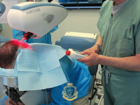 What Is the Process of a Robotic Hair Transplant?