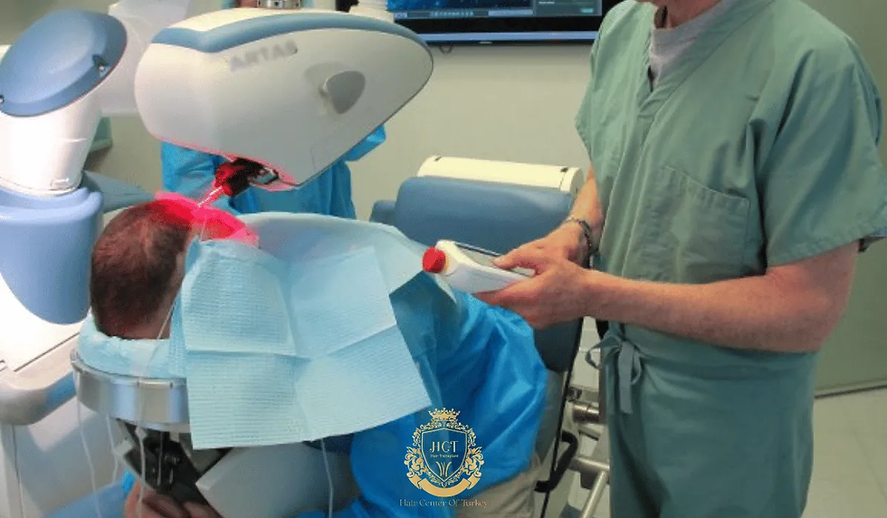 What Is the Process of a Robotic Hair Transplant?