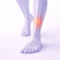 Illustration of stress fracture showing focal bone pain in the lower leg and foot for running injury physical therapy in Eugene, Oregon